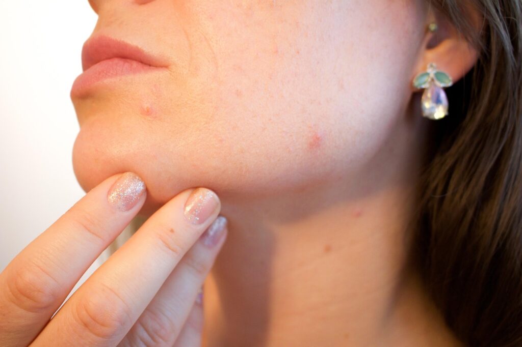 夏の毛穴対策に最適なスキンケア方法は30代にどれが効果的？