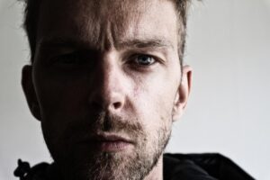 30代の肌荒れを改善するためのセルフケアの限界は？